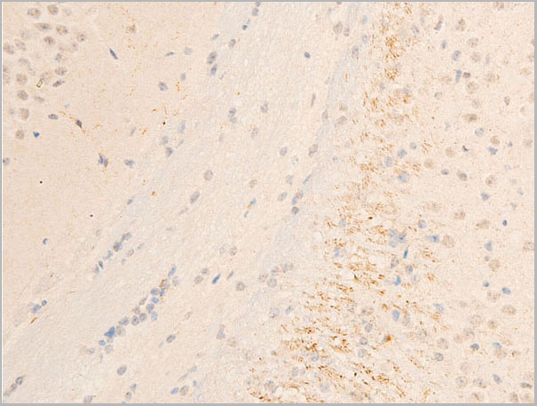 product-image-AAA30937_IHC4.jpg
