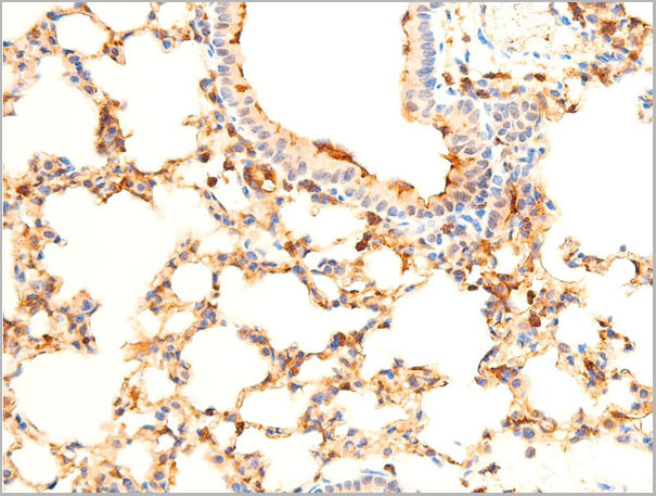 product-image-AAA30937_IHC5.jpg