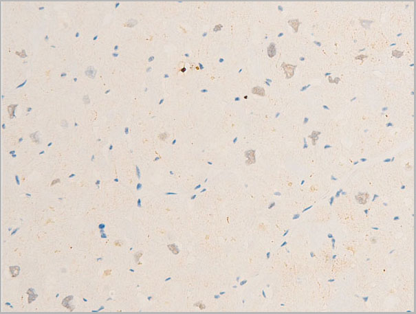 product-image-AAA30937_IHC6.jpg