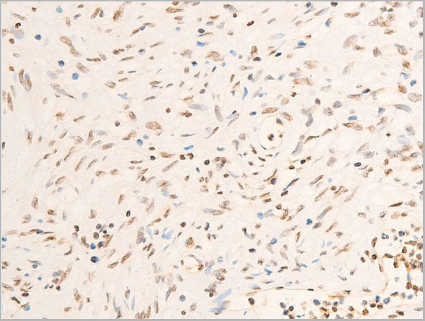product-image-AAA30938_IHC12.jpg