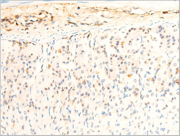 product-image-AAA30938_IHC6.jpg
