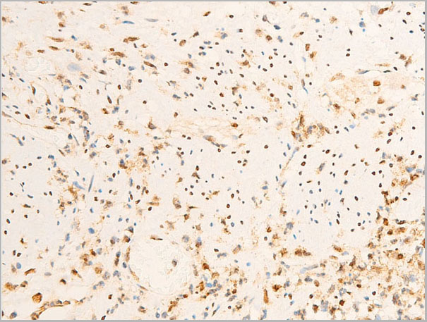 product-image-AAA30938_IHC8.jpg