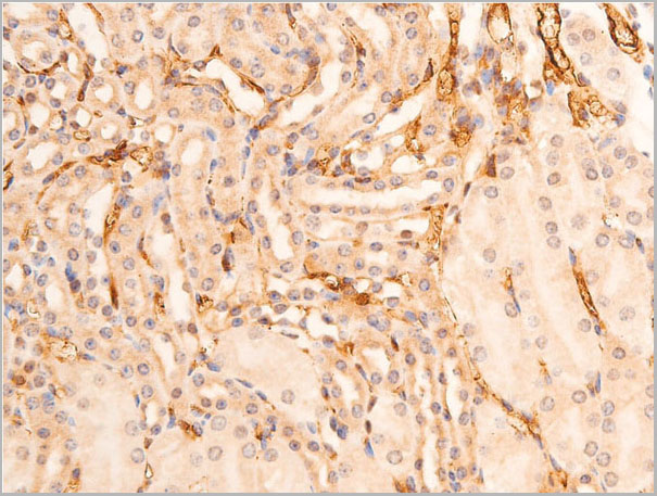 product-image-AAA30939_IHC5.jpg