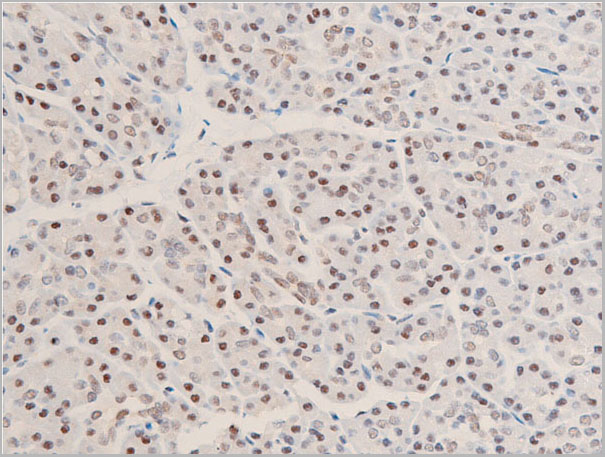 product-image-AAA30939_IHC8.jpg