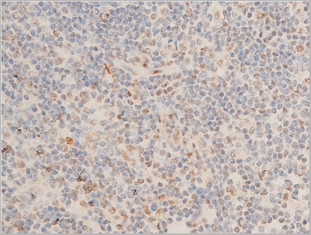 product-image-AAA30939_IHC9.jpg