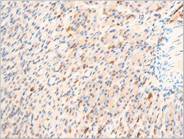 product-image-AAA30940_IHC4.jpg