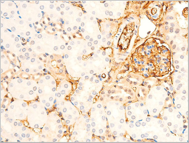 product-image-AAA30940_IHC5.jpg