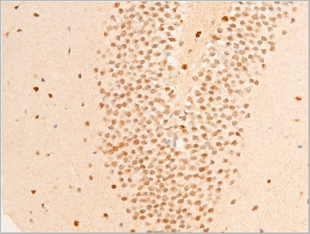 product-image-AAA30940_IHC6.jpg