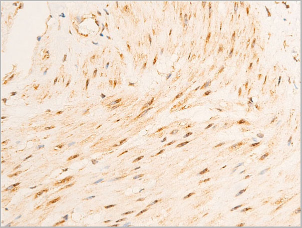 product-image-AAA30940_IHC8.jpg