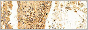 product-image-AAA30941_IHC2.jpg