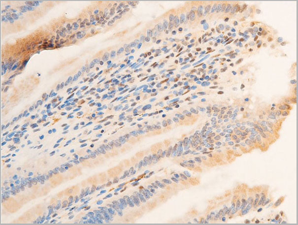 product-image-AAA30942_IHC11.jpg