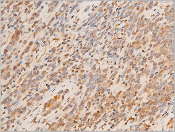 product-image-AAA30942_IHC2.jpg