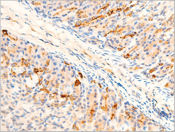product-image-AAA30942_IHC4.jpg