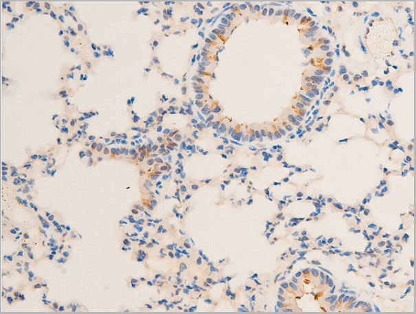 product-image-AAA30942_IHC7.jpg