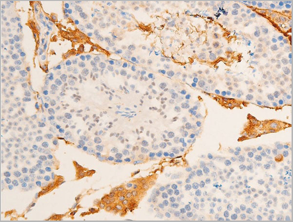 product-image-AAA30943_IHC11.jpg