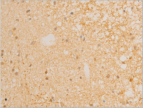 product-image-AAA30943_IHC5.jpg