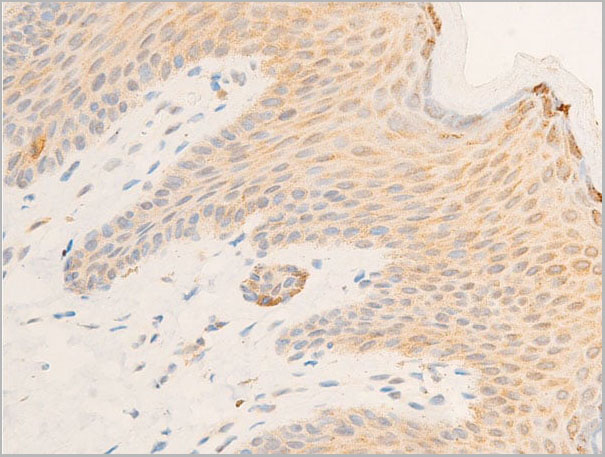 product-image-AAA30943_IHC6.jpg