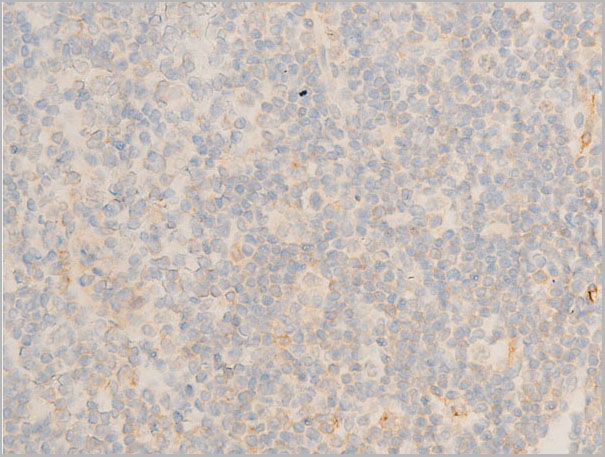 product-image-AAA30943_IHC7.jpg