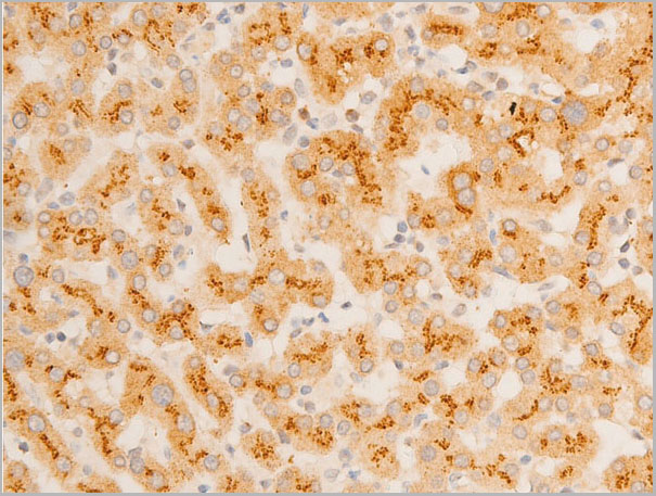 product-image-AAA30943_IHC8.jpg