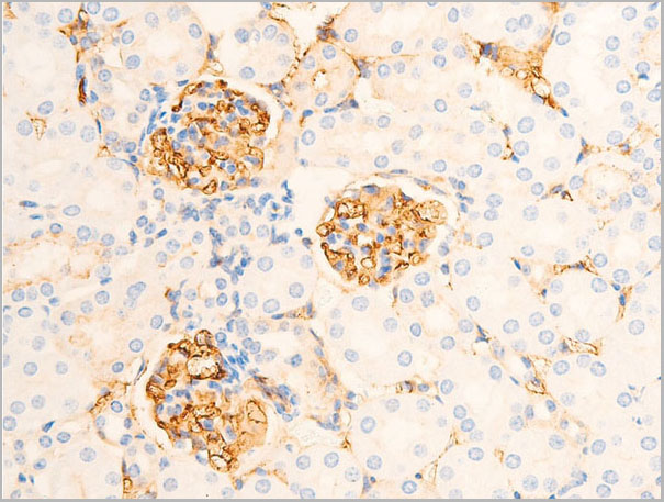 product-image-AAA30943_IHC9.jpg