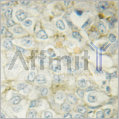 product-image-AAA30944_IHC3.jpg