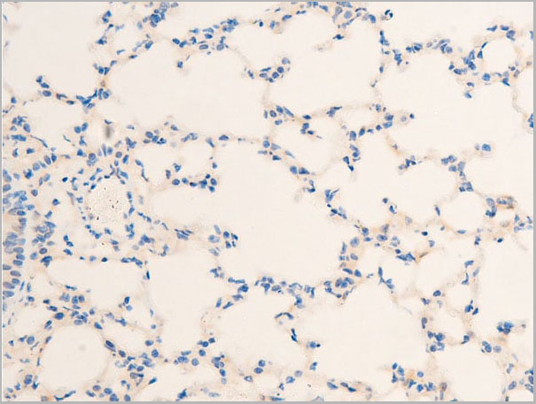 product-image-AAA30944_IHC6.jpg