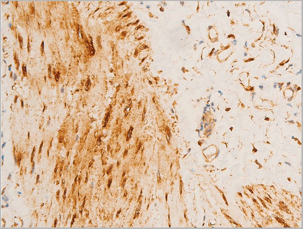 product-image-AAA30944_IHC8.jpg