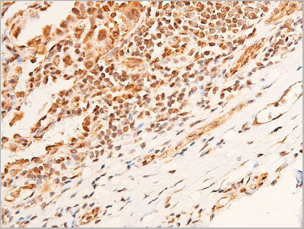product-image-AAA30945_IHC11.jpg