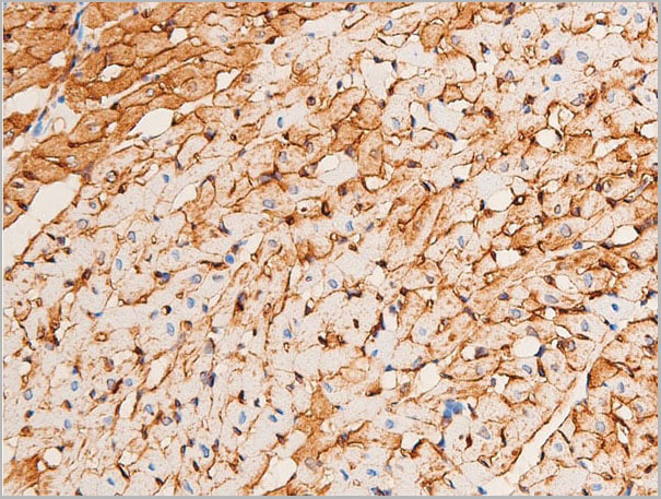 product-image-AAA30945_IHC12.jpg