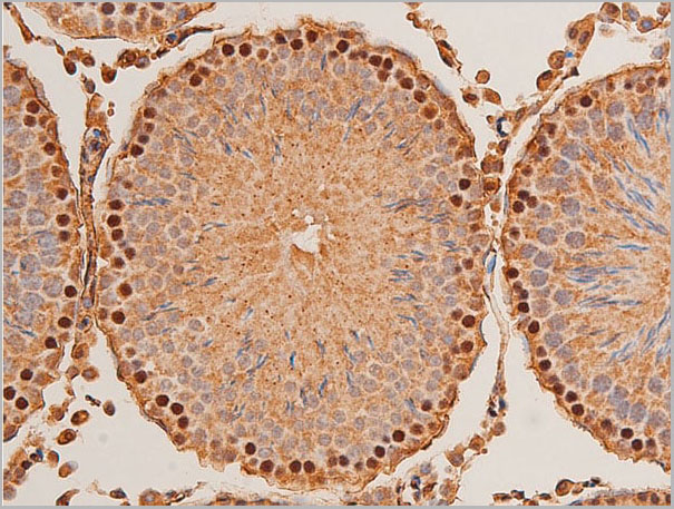 product-image-AAA30945_IHC13.jpg