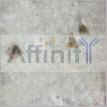 product-image-AAA30945_IHC4.jpg