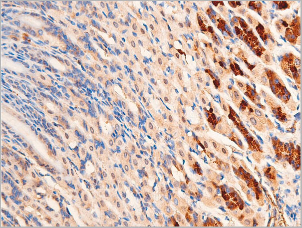 product-image-AAA30945_IHC5.jpg