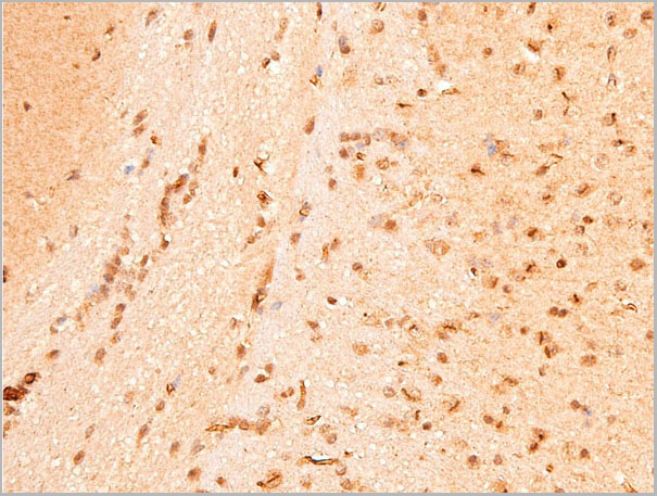product-image-AAA30945_IHC6.jpg