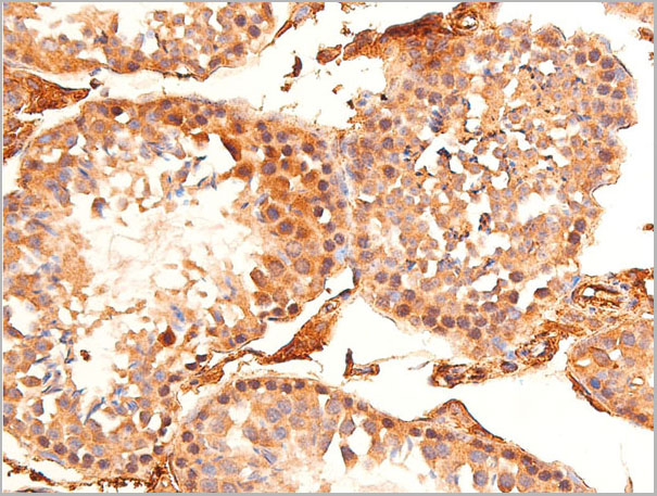 product-image-AAA30945_IHC7.jpg