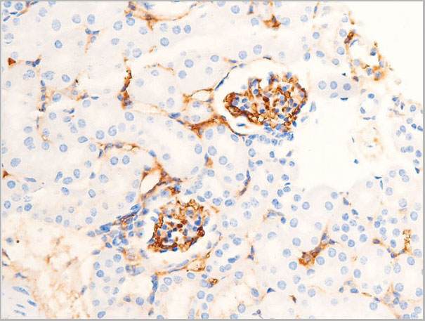 product-image-AAA30946_IHC5.jpg