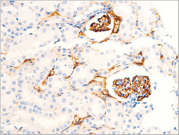 product-image-AAA30947_IHC5.jpg