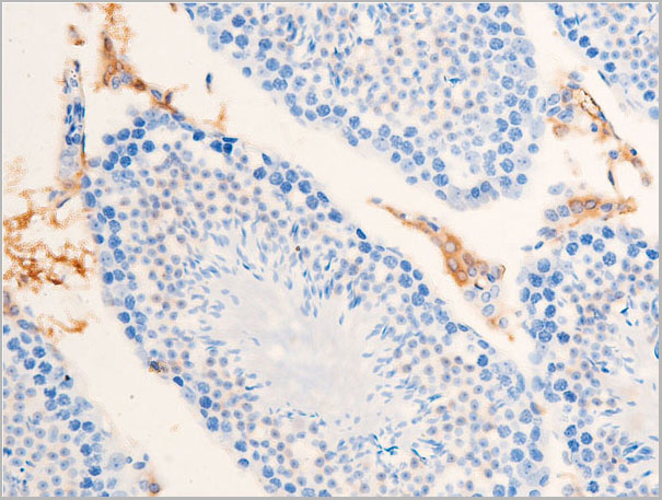 product-image-AAA30947_IHC7.jpg