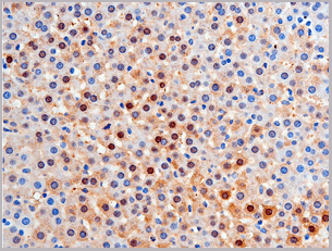 product-image-AAA30948_IHC10.gif