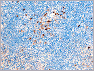 product-image-AAA30948_IHC3.gif