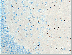 product-image-AAA30948_IHC4.gif