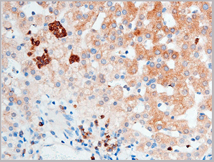 product-image-AAA30948_IHC5.gif