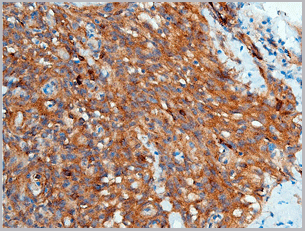product-image-AAA30948_IHC6.gif