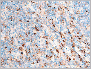 product-image-AAA30948_IHC7.gif