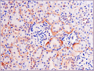 product-image-AAA30948_IHC8.gif