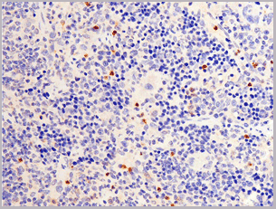 product-image-AAA30948_IHC9.gif