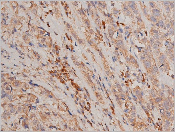 product-image-AAA30949_IHC2.jpg