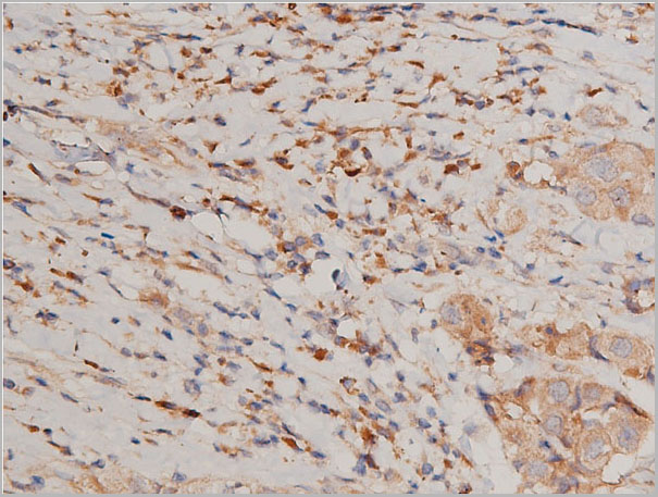 product-image-AAA30949_IHC3.jpg