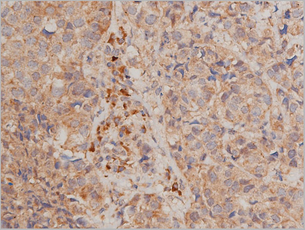 product-image-AAA30949_IHC7.jpg
