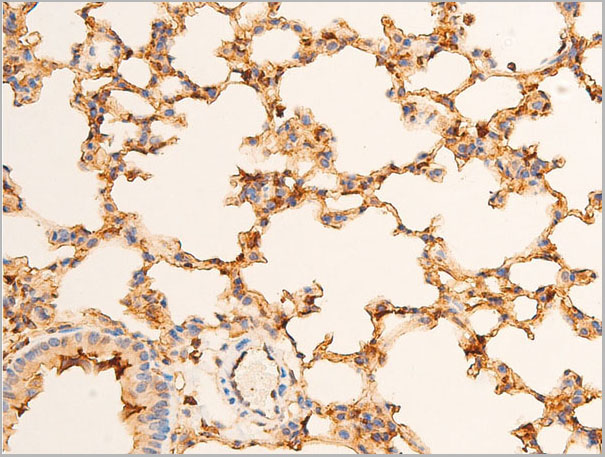 product-image-AAA30950_IHC3.jpg