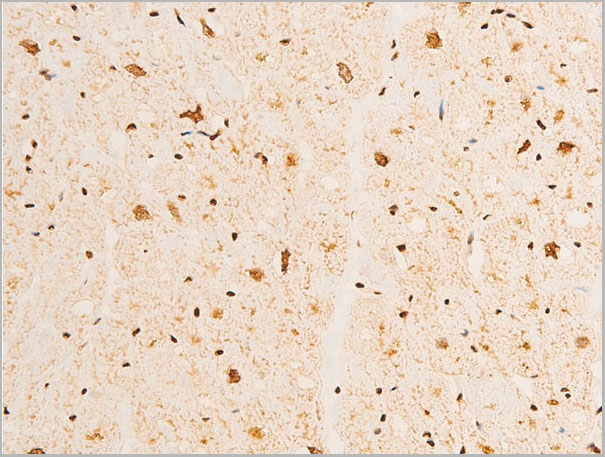 product-image-AAA30950_IHC4.jpg